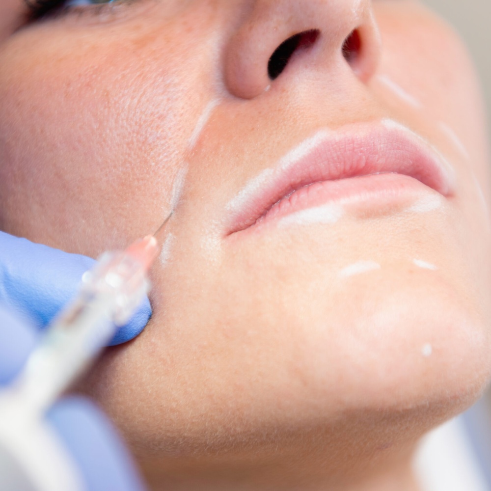 Medical procedure with hyaluronic acid